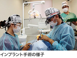 インプラント手術の様子